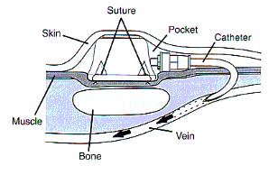 port drawing
